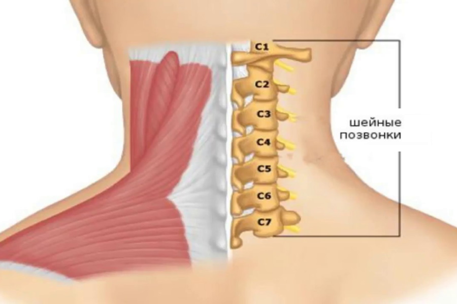 Боли в шее - причины, симптомы и лечения боли в шейном отделе